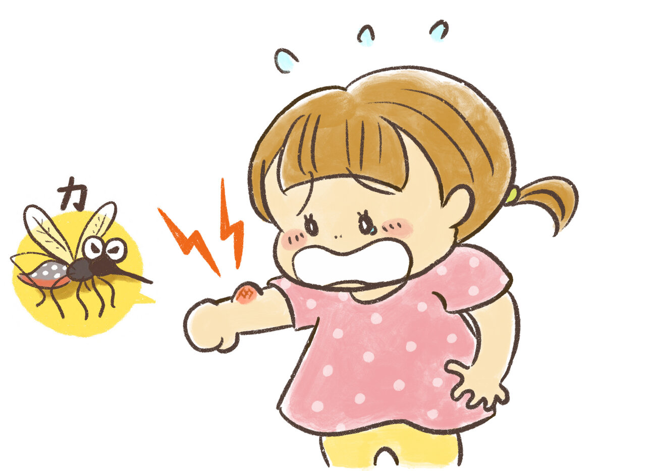 蚊に刺されたアレルギー