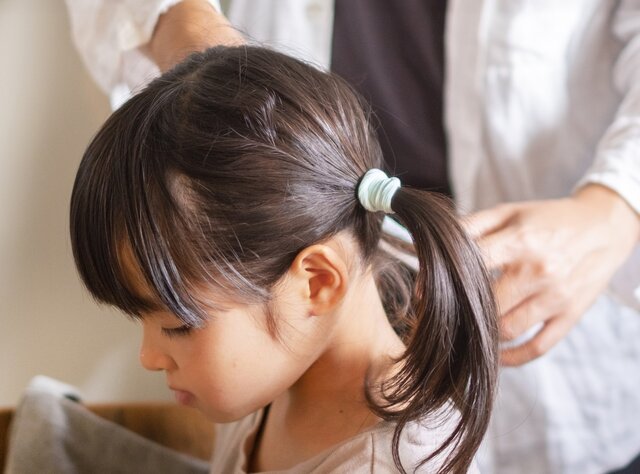 「子どもの頭に10円ハゲが見つかった！」ストレスの心配よりも親が知っておくべき正しい知識とは［専門医が解説］
