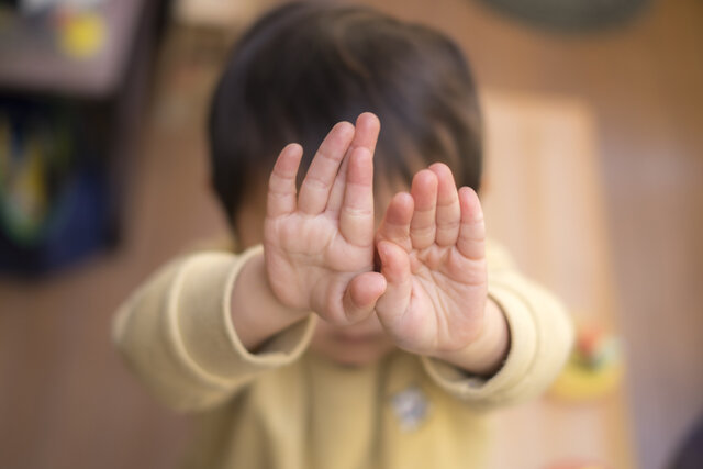 「子どもの円形脱毛症」早期治療・あせらず継続を「親ができること・してはいけないこと」［専門医が解説］