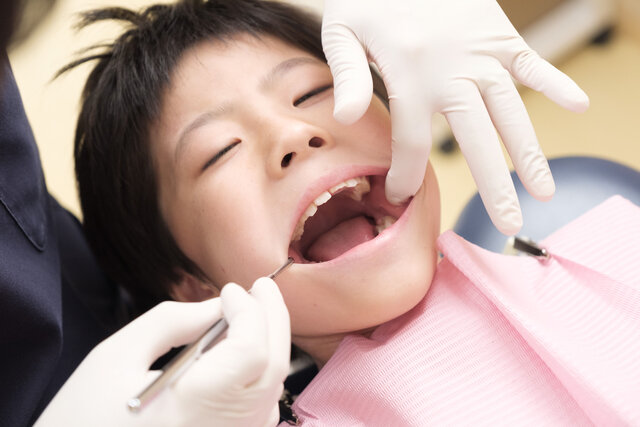 【子どもの口のケガ】抜けた・折れた・飲み込んだ！　症状別「応急処置」とは？　〔小児歯科専門医指導医〕がわかりやすく解説