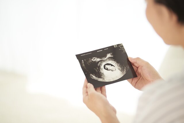 【産婦人科医監修】妊娠4ヵ月(12~15週)は「安定期」? 食事・運動のポイントと里帰り出産の準備