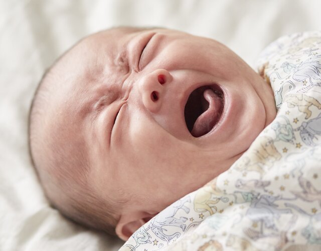 赤ちゃんの頭にブツブツやかさぶたが!?　「乳児脂漏性皮膚炎」　アトピーとの見分け方と正しい対策とは［医師監修］